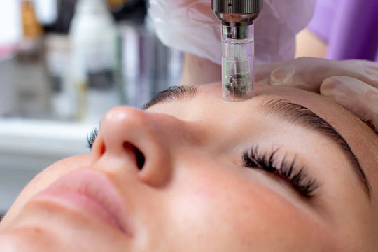 Is Microneedling Safe?