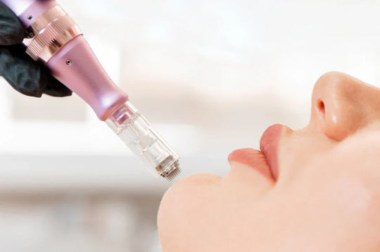 What Is Microneedling Used for?