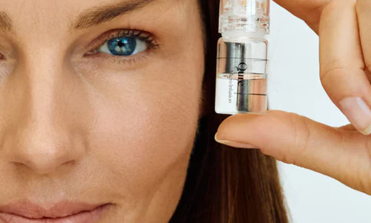 Microneedling for Blackheads
