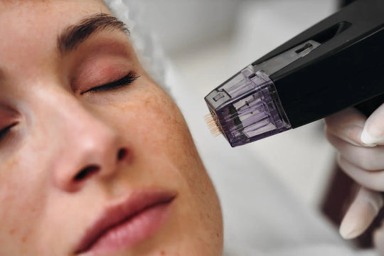 Does Microneedling Cause Bleeding?