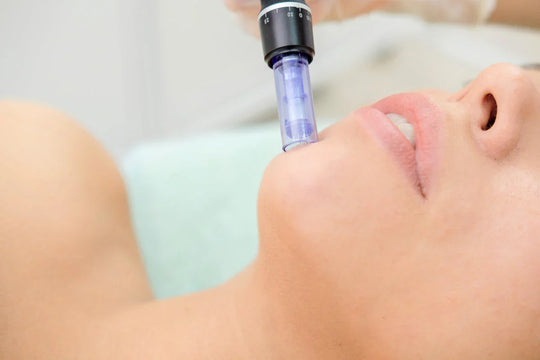 How Long Does Microneedling Last?