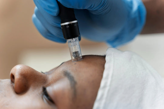 How Often to Do Microneedling