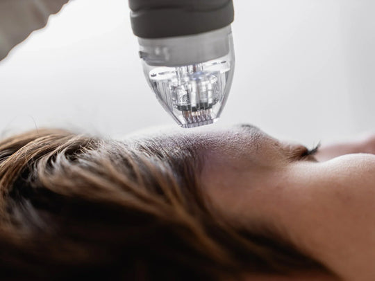 Microneedling While Breastfeeding
