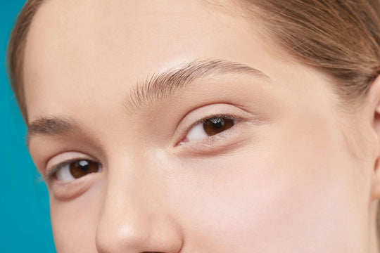 Microneedling with Hyaluronic Acid