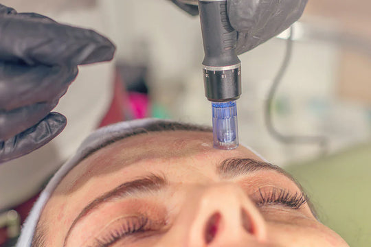 What Does Microneedling Feel Like?